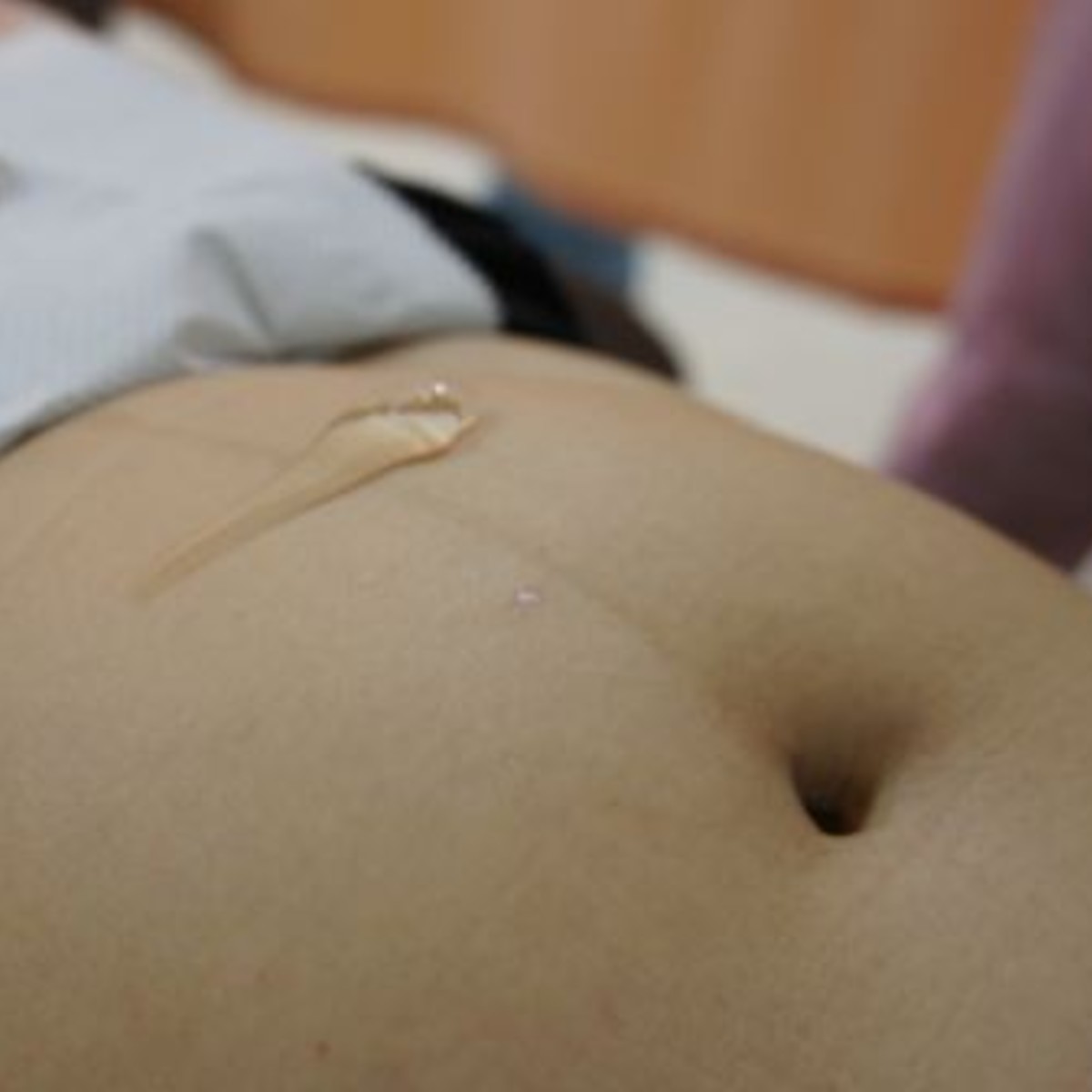 羊膜穿刺注意事項 宅女日記